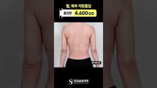 위에서부터 라인, 은근 차이 남 👀