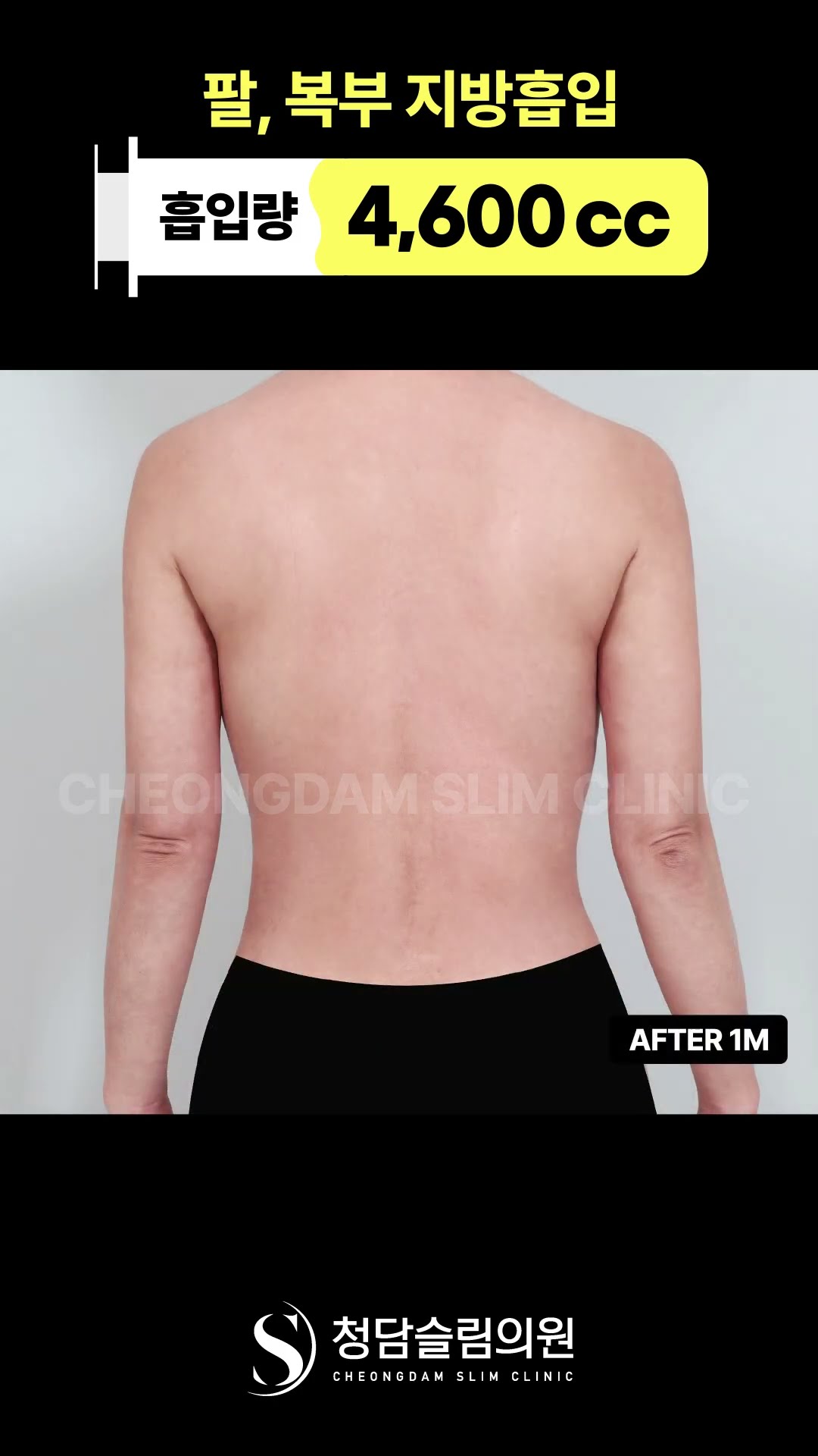 위에서부터 라인, 은근 차이 남 👀