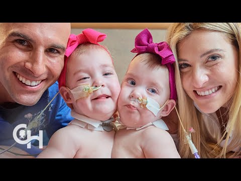 The Separation of Conjoined Twins Lily and Addy Altobelli | Children
