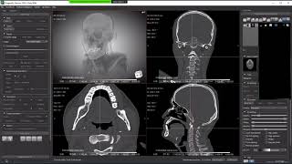 Download the video "Using the Segmentation Wizard tool to train a Deep Learning model for your image segmentation tasks."