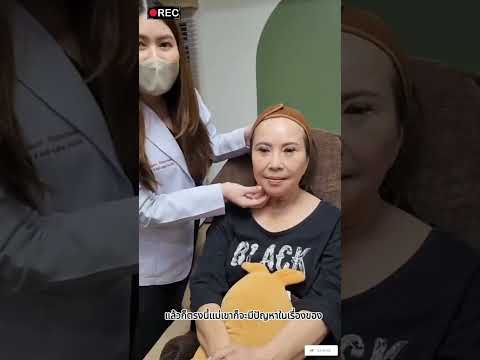 รีวิวหัตถการโปรแกรม Botox