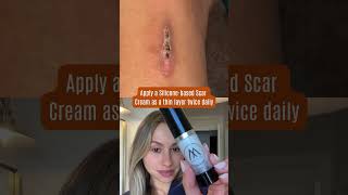 This is How this Silicone- based Scar Cream will HEAL your Scars!