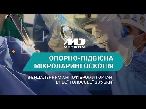 Мікроларингоскопія - операція по відновленню голосу - відео