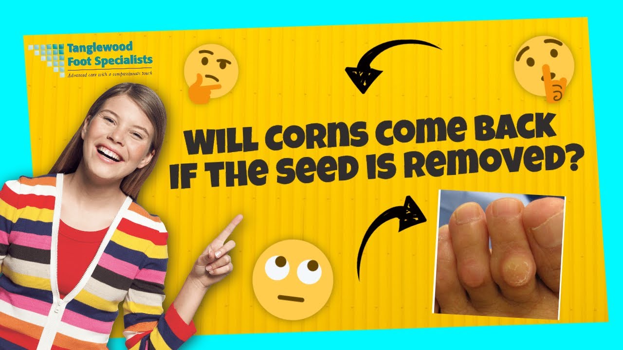 Will Corns Come Back if the Seed is Removed?