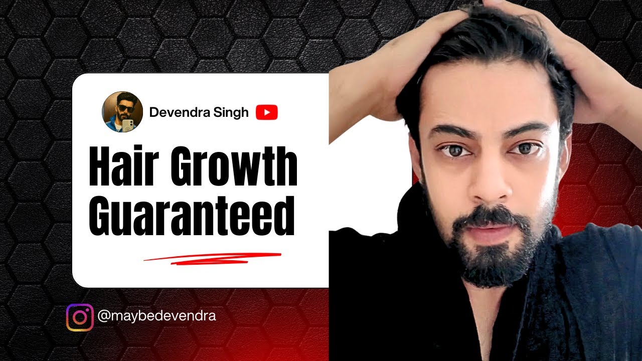 NO MINOXIDIL REQUIRED | Budget Hair Growth Methods
