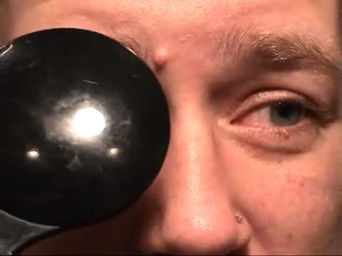 Refractometrie oftalmologie