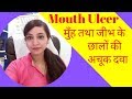 Mouth ulcer homeopathic medicine | Tongue ulcer homeopathic medicine | home remedy & treatment Mouth ulcer homeopathic medicine | Tongue ulcer homeopathic medicine | home remedy & treatment