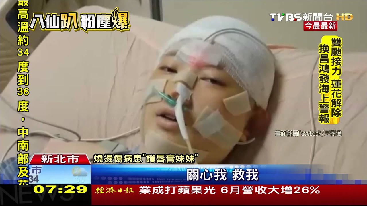 病況好轉! 「護唇膏妹妹」拍影片鼓勵傷患