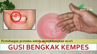 Download lagu Kempes Seketika|Cara mengobati gusi bengkak dengan cepat mp3