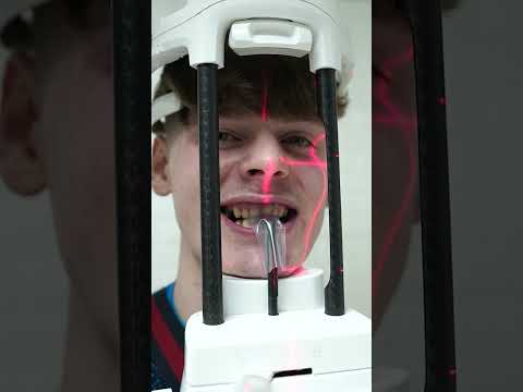 @JOSHTATEMUSIC, THE POPULAR RAPPER "LITTLE T", RECREATED HIS SMILE WITH PURE WHITE ZIRCONIUM CROWN