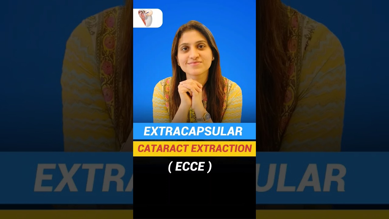 Extracapsular Cataract Extraction (ECCE) Explained