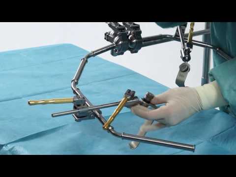 Retractor for ventral access / Spine Surgery