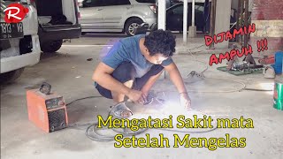 Download lagu Treating sore eyes after welding #rayhanmotorpku #welder #welding #welding #automotive mp3 Download lagu Treating sore eyes after welding #rayhanmotorpku #welder #welding #welding #automotive mp3