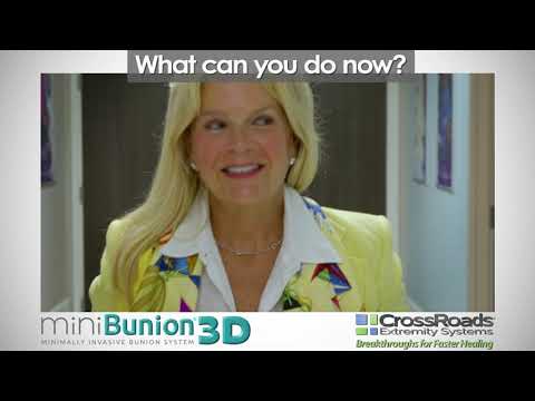 miniBunion® 3D FAQs "What can you do now?"