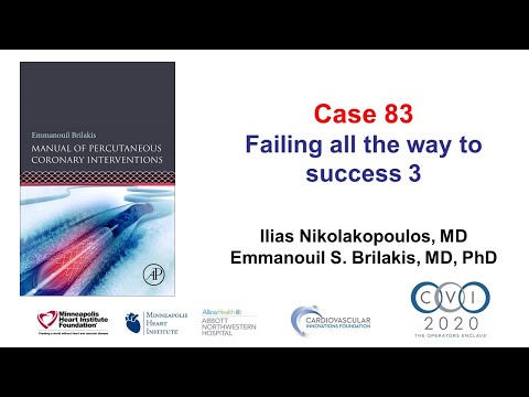 Case 83: PCI Manual - Failing all the way to success 3