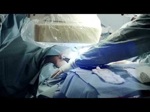 PRIMO MEDICO - Vorstellung Dr. med. Reza Ghotbi vom HELIOS Klinikum München West