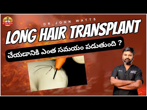 Different Hair Lines Explained