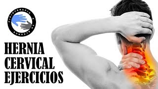 Hernia discal cervical o hernia de disco cervical tratamiento y ejercicios para aliviar el dolor