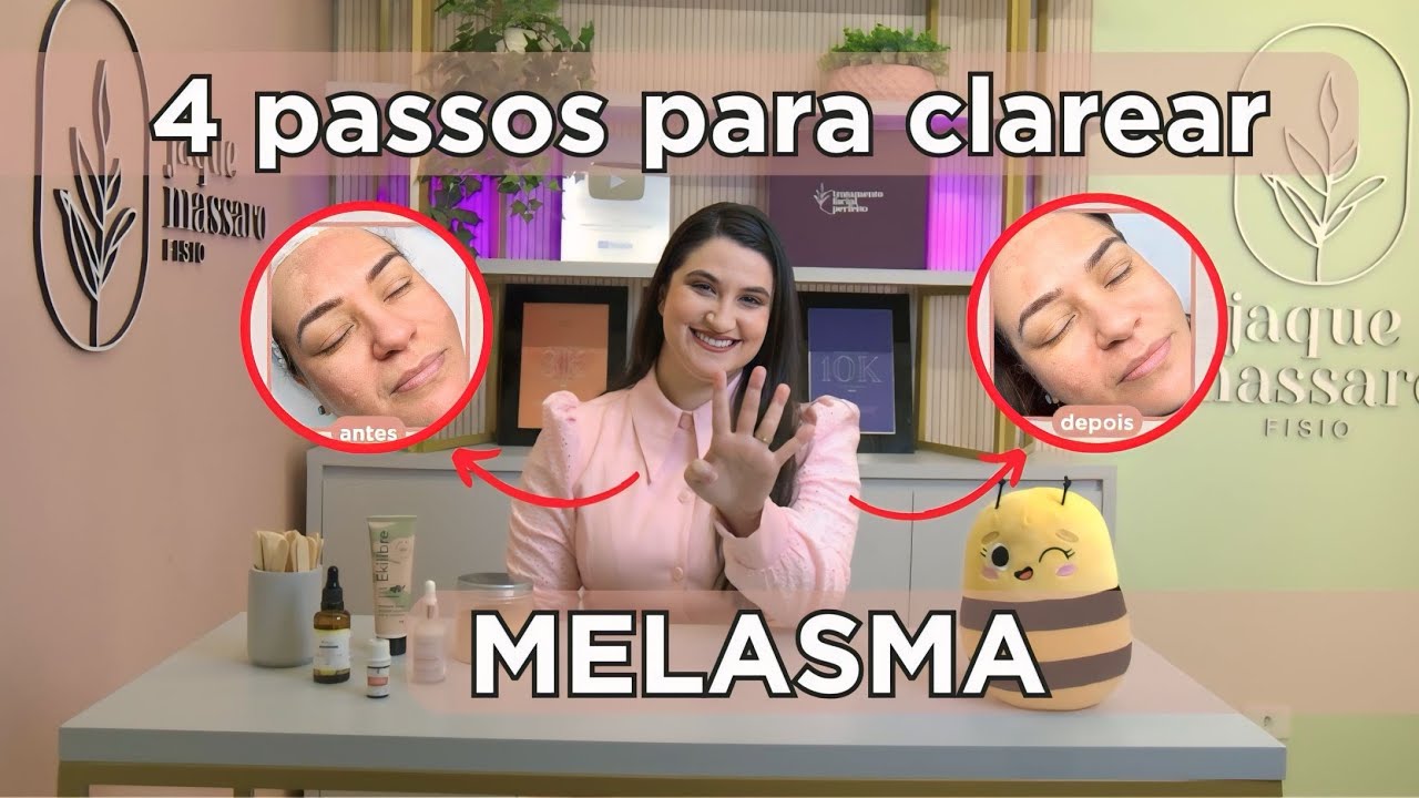 4 passos para ter mais resultados no clareamento de Melasma! 2024