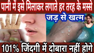 Download lagu जड़ से खत्म | masse ko kaise hataye | masse ka gharelu ilaj | masa ka ilaj | massa hatane ka tarika mp3