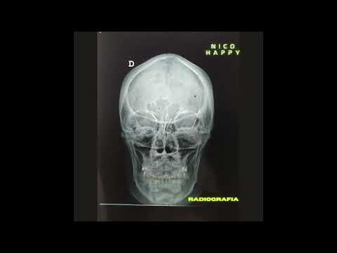 Nico Happy - Radiografía (FULL EP 2023)