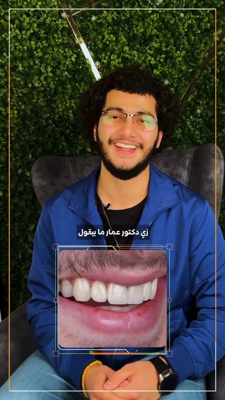 سوريا – تركيبات