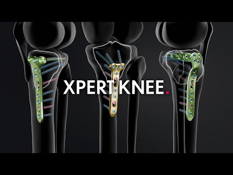 Xpert Knee range - Tibial trauma plates