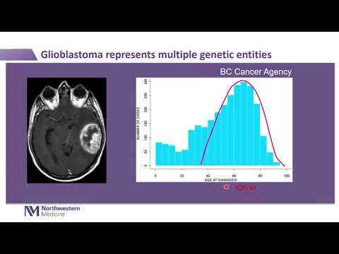 A Contemporary Molecular View of Diffuse Gliomas with Implications for Diagnosis and Treatment
