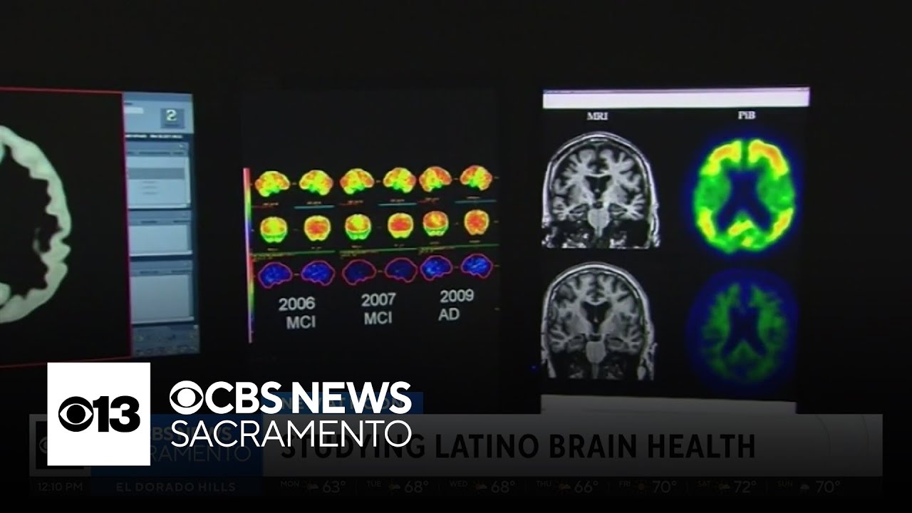 UC Davis studying Latino brain health