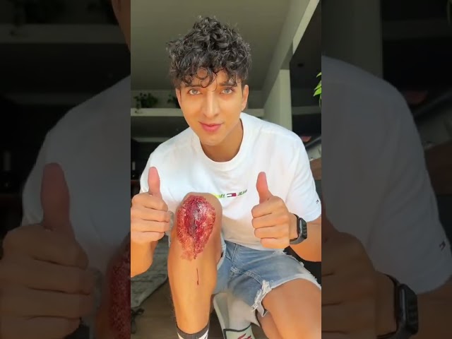Vídeo relacionado con OUDQFCJ Gafas divertidas con nariz grande,cejas y bigote (2 piezas),gafas de plástico sin graduación para adultos,accesorio para bromas,carnaval,fiestas temáticas y eventos de mal gusto
