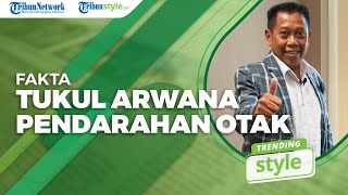 TRENDING STYLE: 5 Fakta Pendarahan Otak Tukul Arwana, termasuk Kronologi Masuk RS