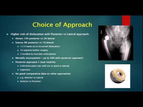 Optimal management of the displaced femoral neck fractures in the elderly