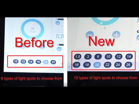 Weifang KM new long pulse laser Alexandrite laser hair removal with 12 spot sizes and AI handpiece