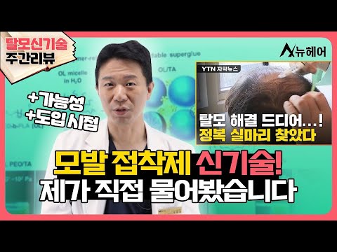 [#탈모신기술 주간리뷰] 모발 접착제 신기술, 제가 교수님께 직접 물어봤습니다