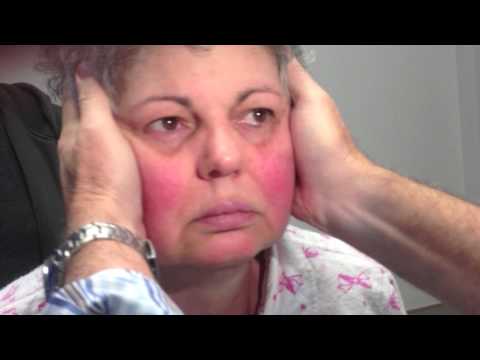 Positive Head Impulse when head turned to the left