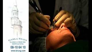 Påsar under ögonen med laser utan synliga snitt