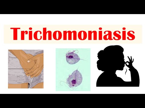 Schistosomiasis Bilharziasis Causes Symptoms and Treatment