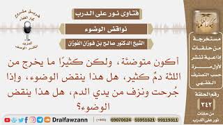 صورة يخرج من اللثة دم كثير، فهل هذا ينقض الوضوء، وإذا جرحت ونزف من يدي الدم، هل هذا ينقض الوضوء؟