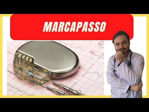 Marcapasso cardíaco