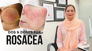 How to Manage Rosacea | Dermatologist