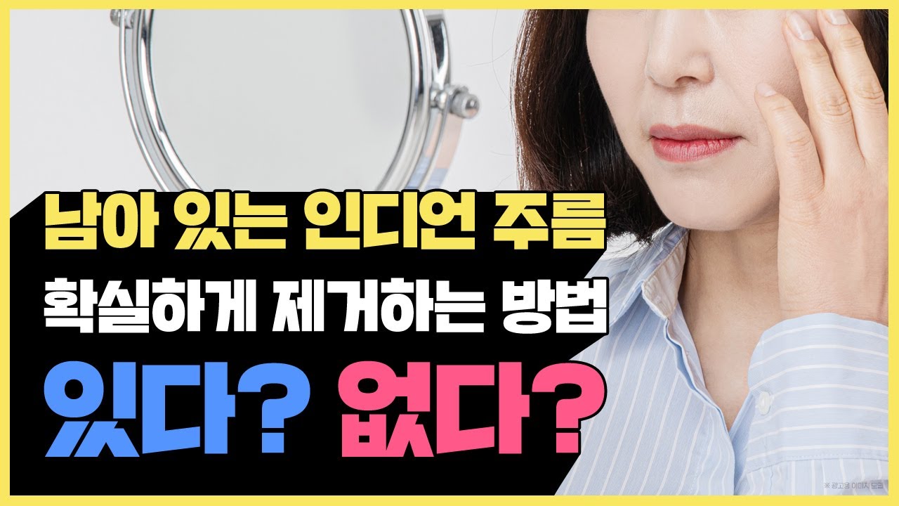 수술해도 없어지지 않는 인디언주름? 비수술로 가능한 방법이 있다는데?? | #인디언주름 #인디언하안검 #중면…