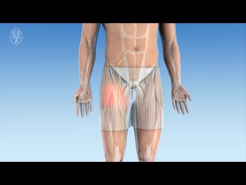 Betäubung von Beinnerven: Die Femoralis- und Ischiadicus-Blockade