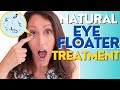 Natural Eye Floater Treatment | 4 Ways to Treat Eye Floaters