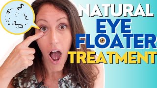 Natural Eye Floater Treatment | 4 Ways to Treat Eye Floaters