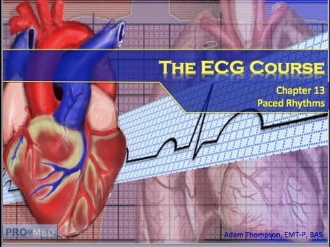 The ECG Course - Paced Rhythms