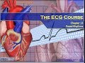 The ECG Course - Paced Rhythms