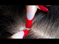 {ASMR} Rare & Specific PICKING & COMBING triggers 😴
