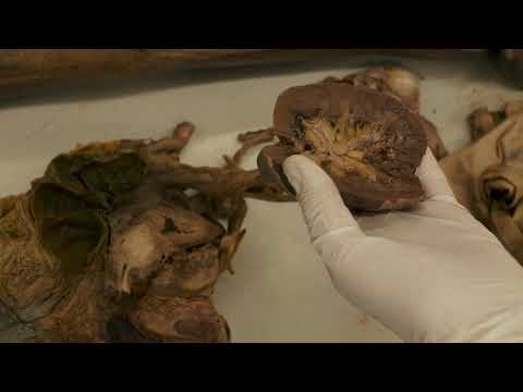 Niere, Harnblase, Prostata, Hoden, Penis kurz und knackig erklärt - Sezierkurs Live Tag 15