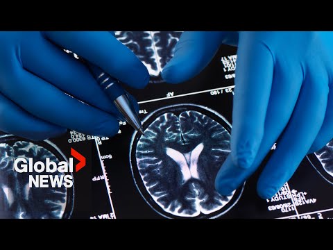 Canadian scientists discover method to slow brain cancer with existing HIV medication