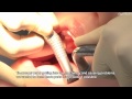 Hanako 2: A Robot Patient For the Amateur Dentists (Video)